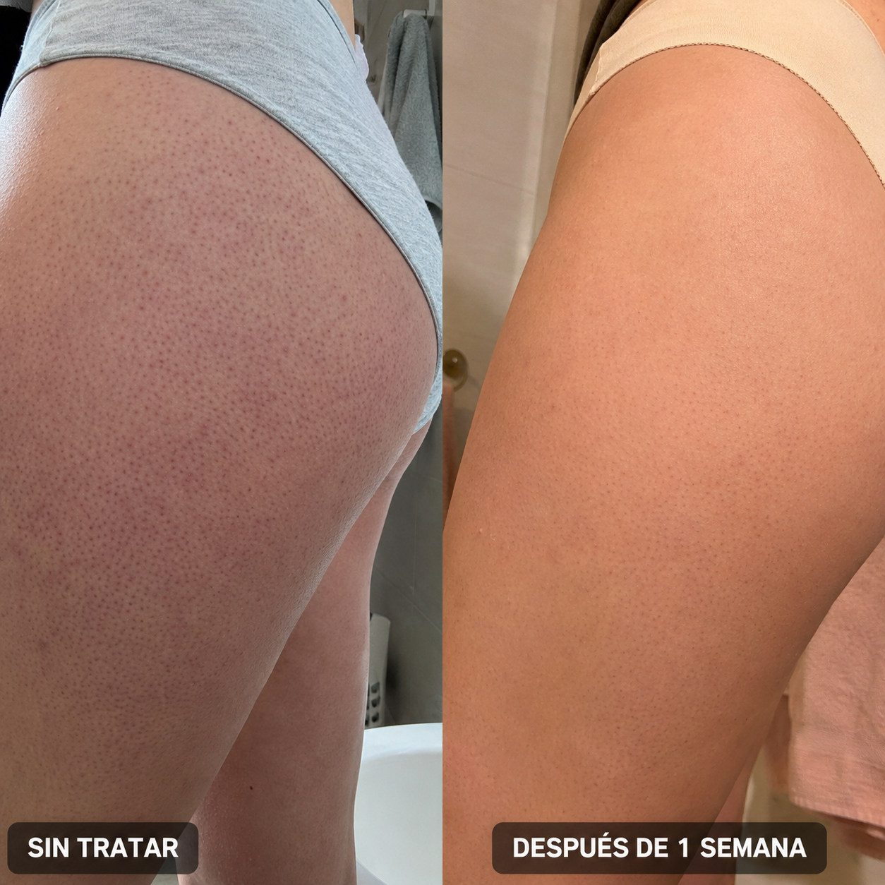 BerrySkin®: Eliminá tu Piel de Frutilla